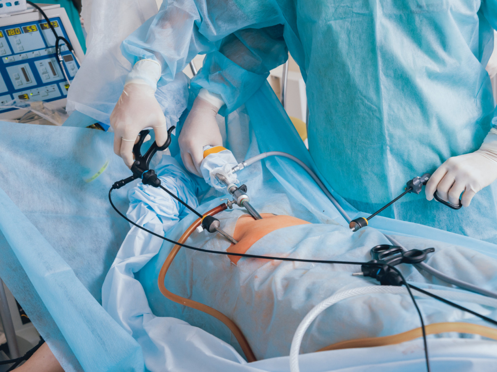 Best Colorectal Surgeon in Anna Nagar